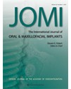 The International Journal of Oral and Maxillofacial Implants